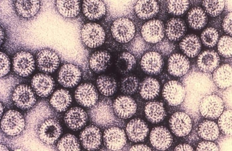 Rotavirus - sve što morate znati o ovoj ozbiljnoj infekciji