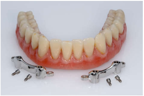 Implantati