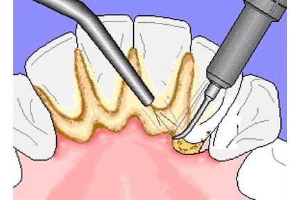 ORDINACIJA DENTALNE MEDICINE DR. AZINOVIĆ