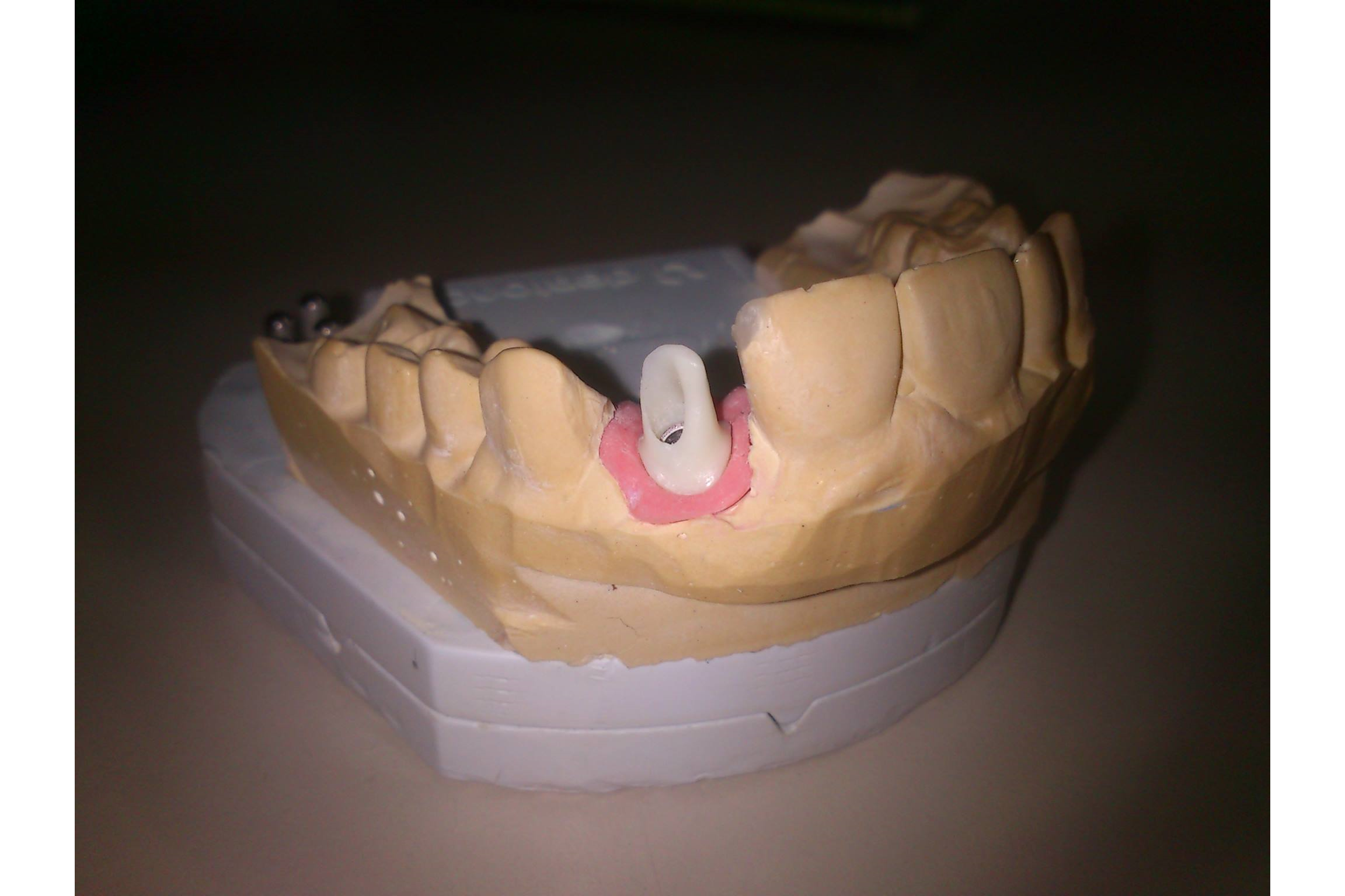 Dentalni laboratorij DENTALTEH