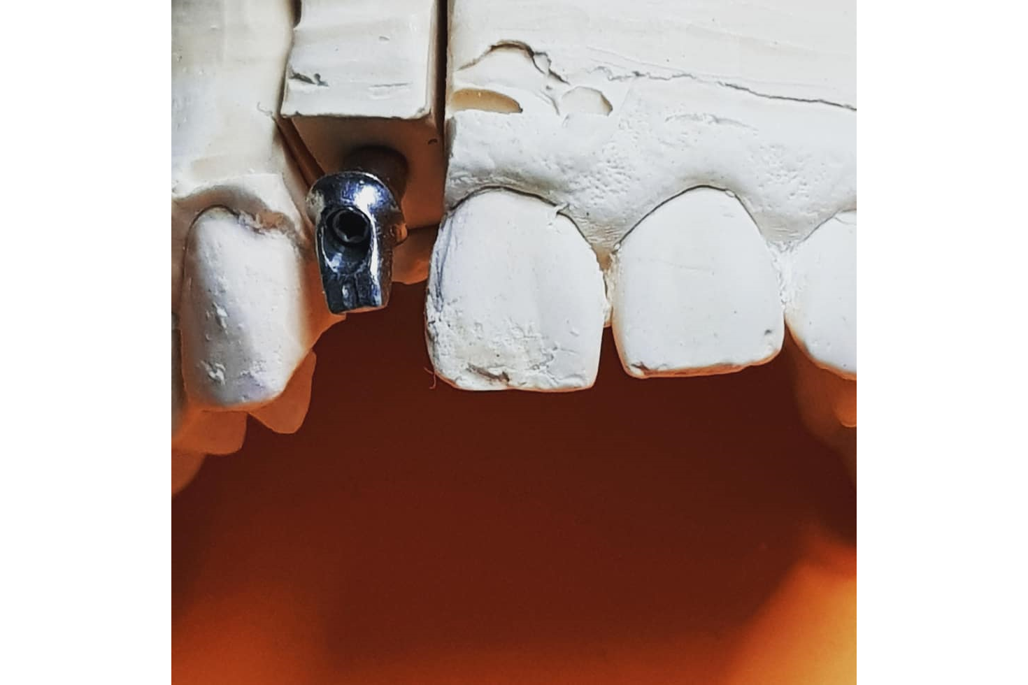 Dentalni laboratorij DENTALTEH