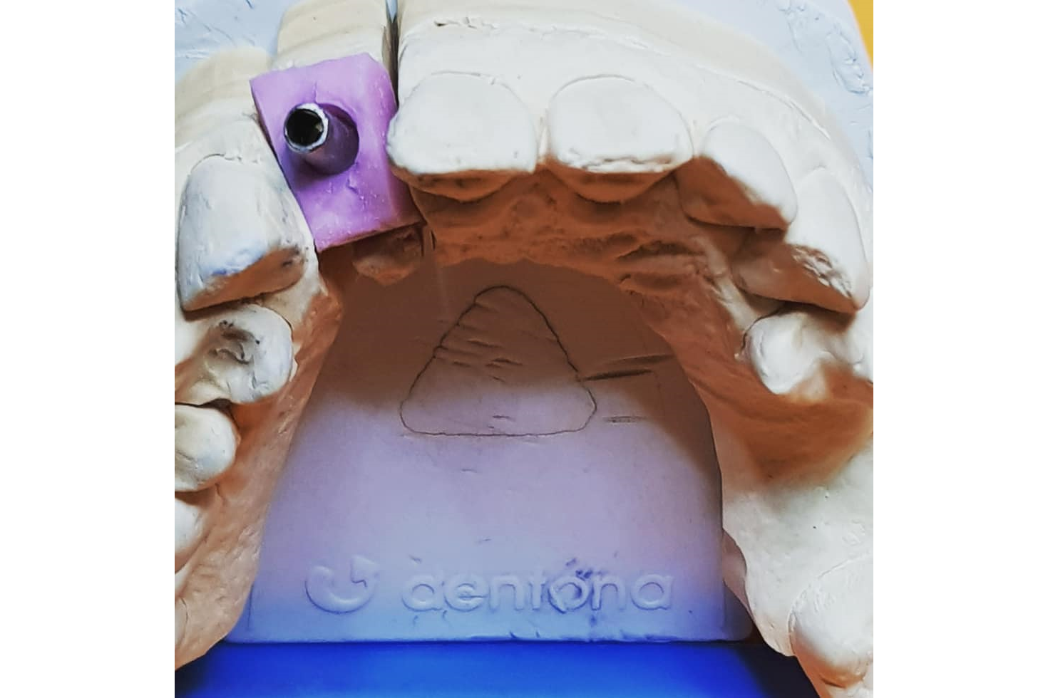 DENTALTEH