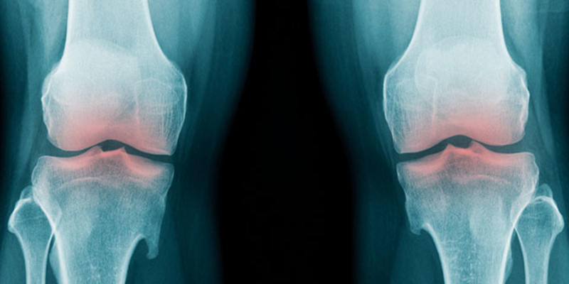 homeopatija zgloba koljena)